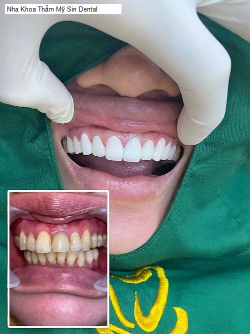 Hình ảnh Nha Khoa Thẩm Mỹ Sin Dental